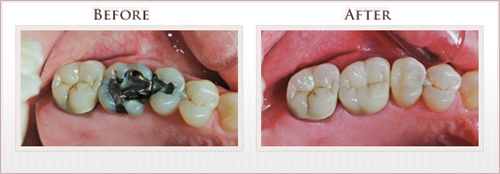 Before and After Photo