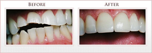 Before and After Photo