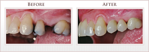 Before and After Photo