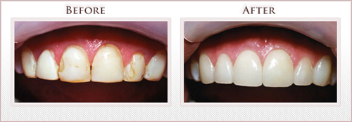 Before and After Photo