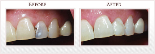 Before and After Photo
